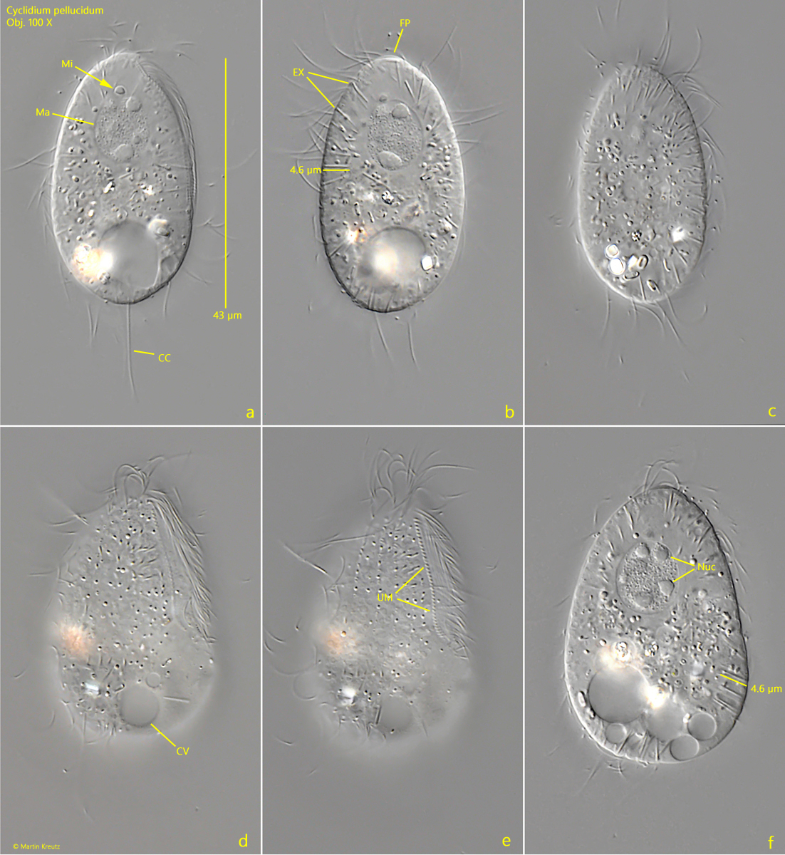 Cyclidium-pellucidum