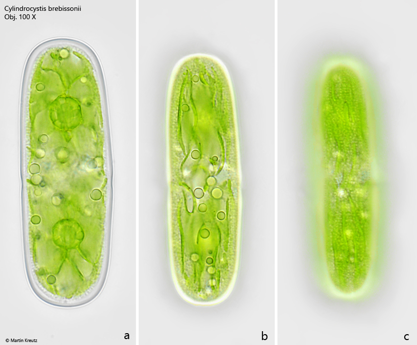 Cylindrocystis-brebissonii