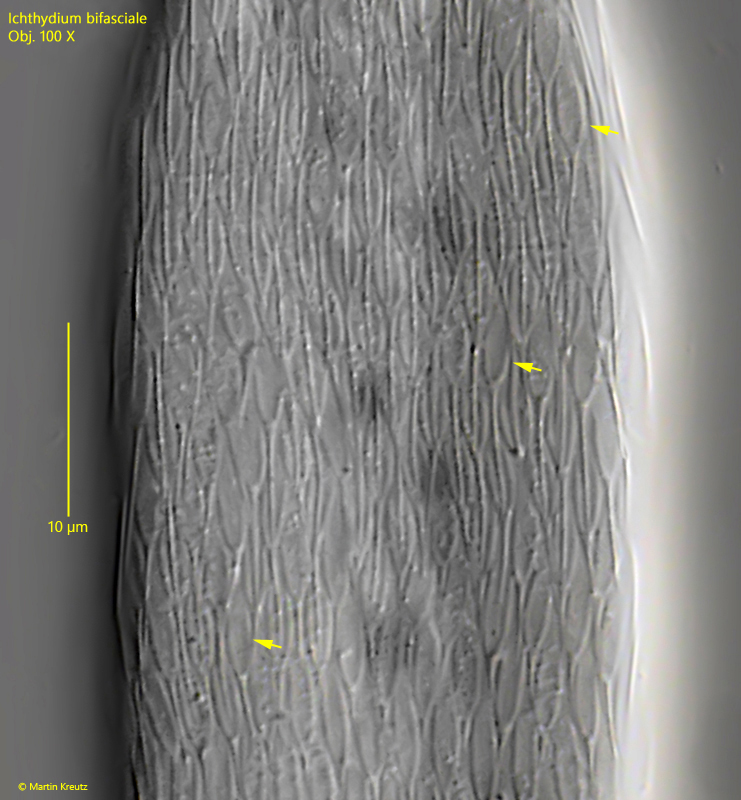 Ichthydium-bifasciale