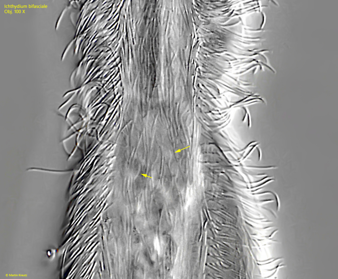 Ichthydium-bifasciale