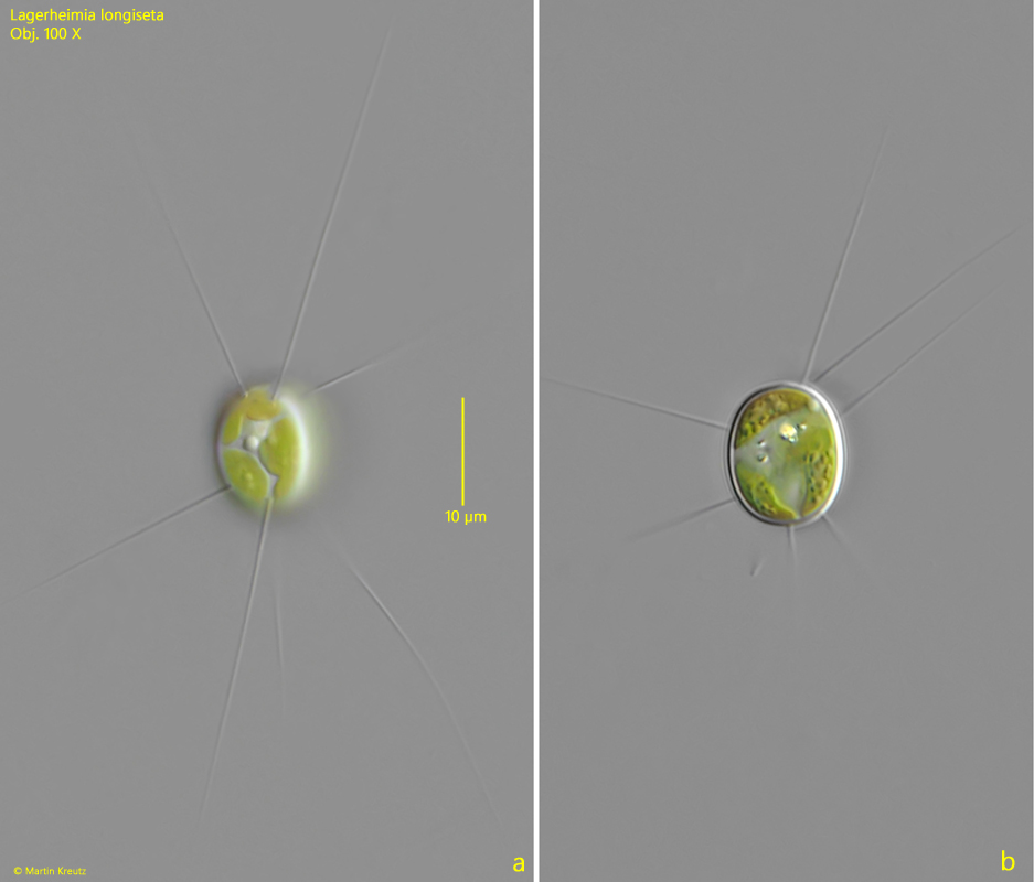 Lagerheimia-longiseta