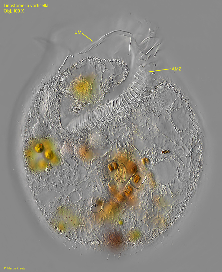 Linostomella-vorticella