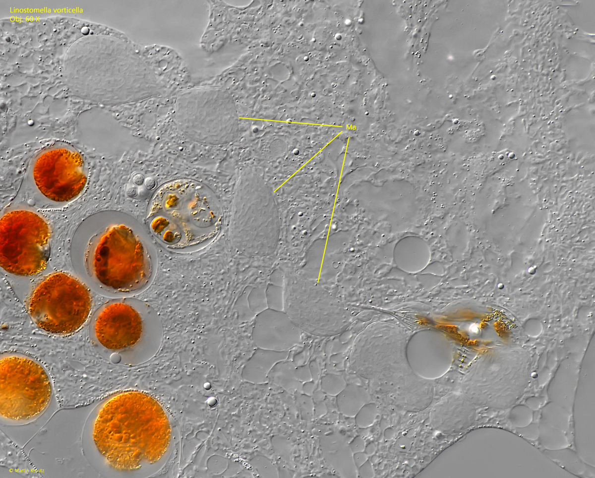 Linostomella-vorticella