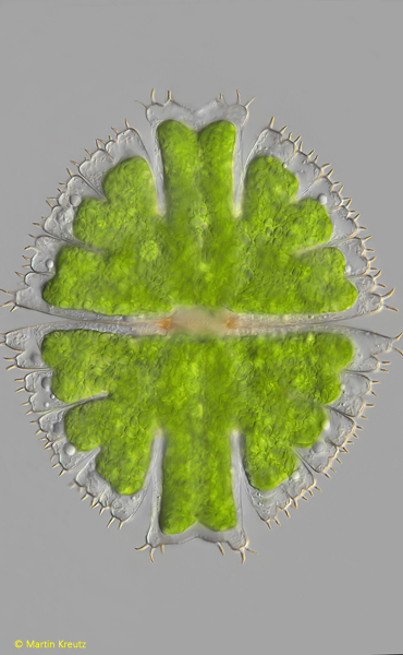 Micrasterias-fimbriata