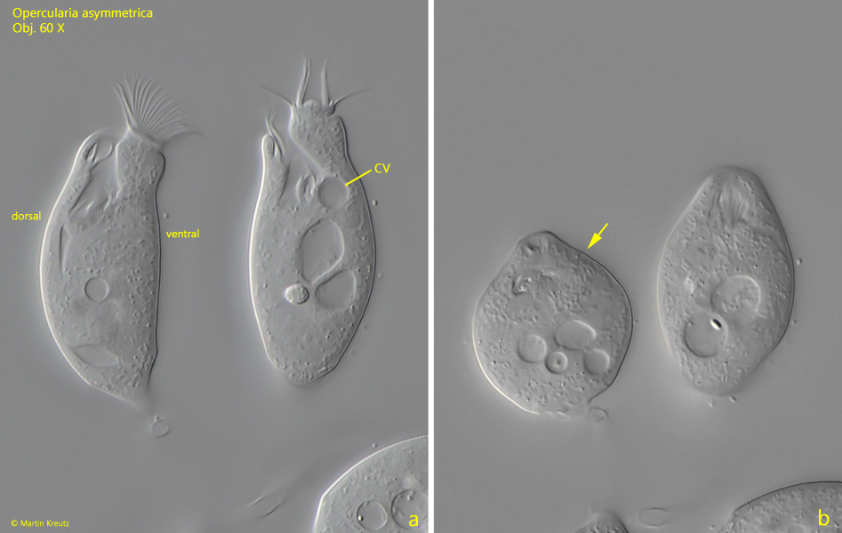 Opercularia asymmetrica