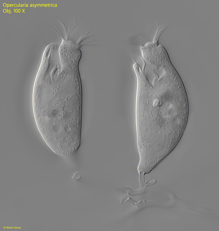 Opercularia asymmetrica