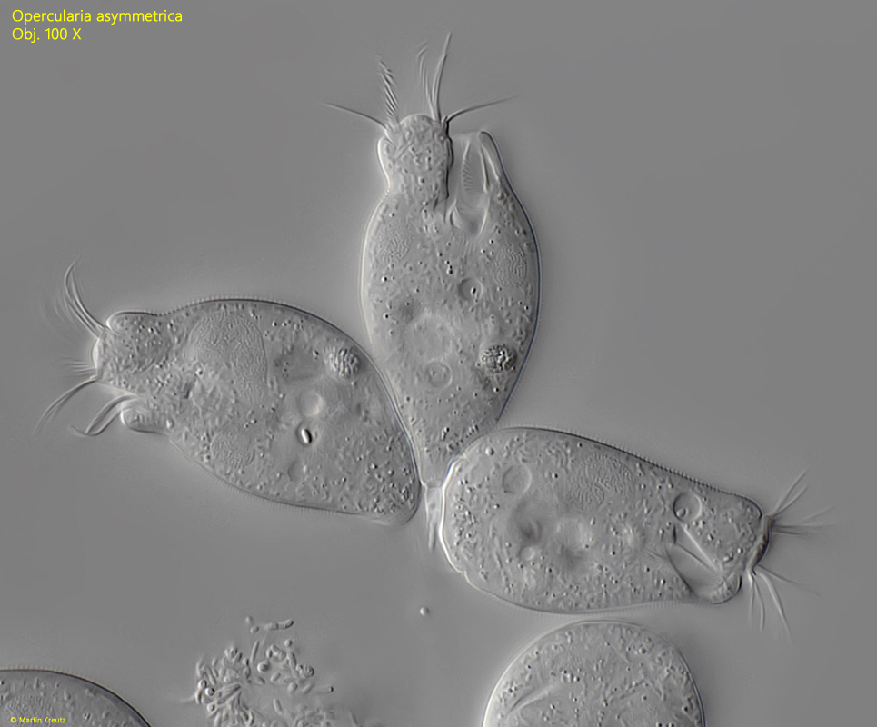 Opercularia asymmetrica
