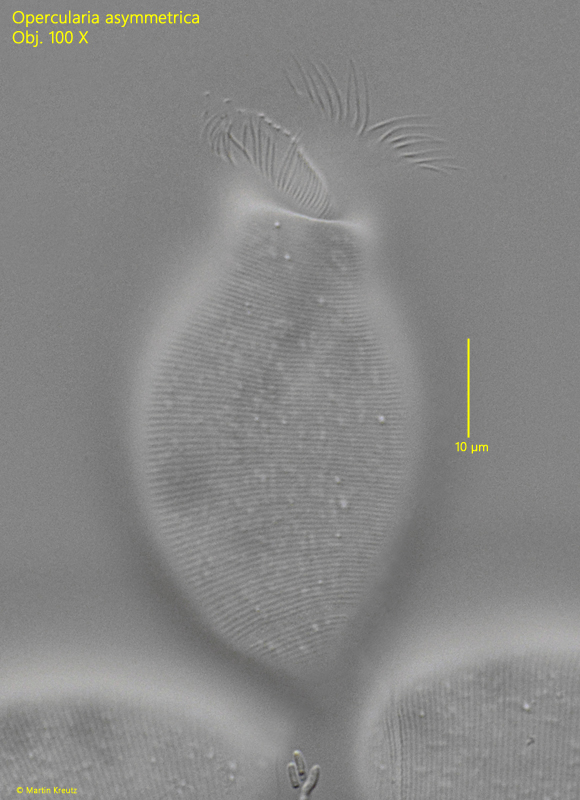 Opercularia asymmetrica