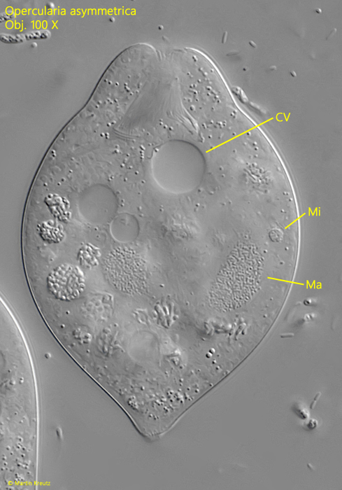 Opercularia asymmetrica
