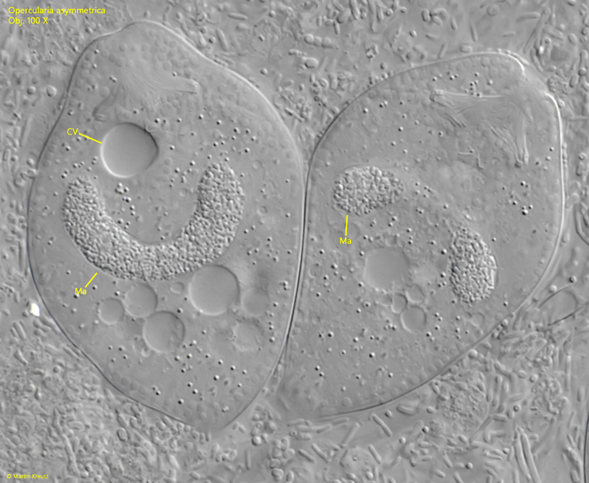 Opercularia asymmetrica