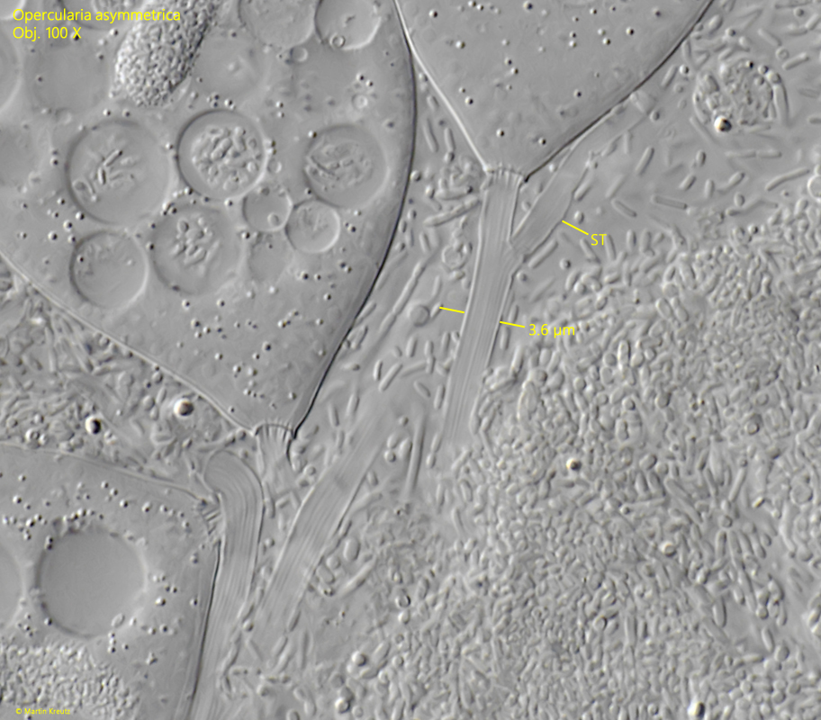 Opercularia asymmetrica