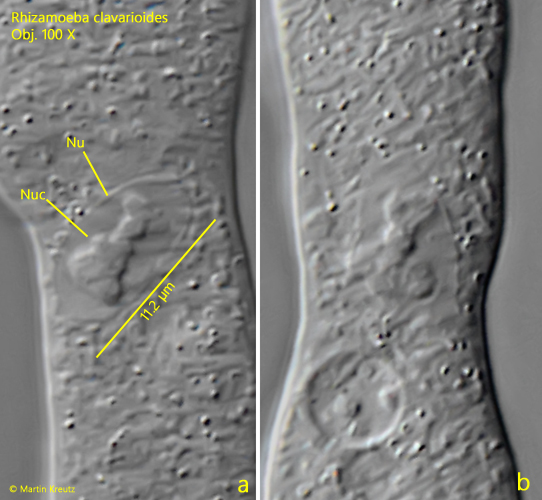 Rhizamoeba-clavarioides