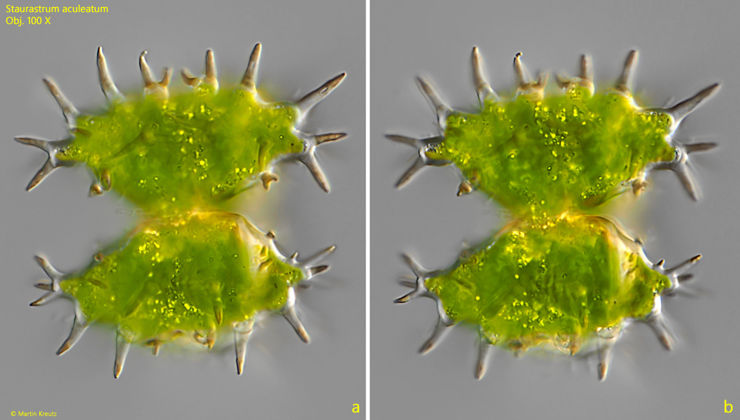 Staurastrum-aculeatum