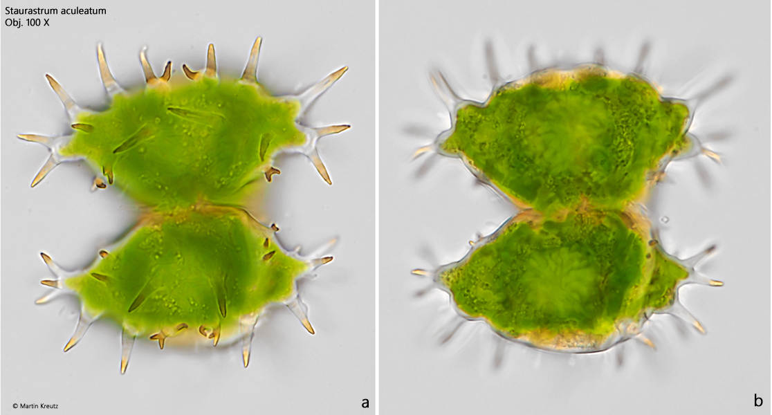 Staurastrum-aculeatum