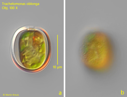 Trachelomonas-oblonga