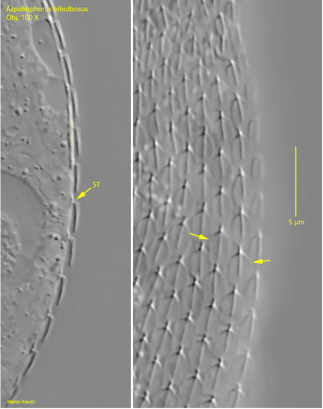Aspidiophorus-bibulbosus
