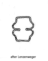Cosmarium-trilobulatum-var-depressum