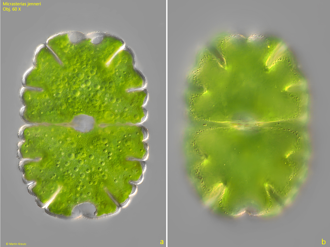 Micrasterias-jenneri