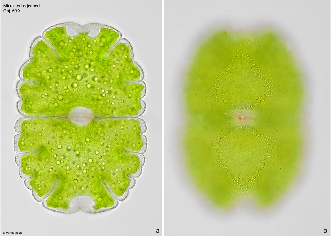 Micrasterias-jenneri