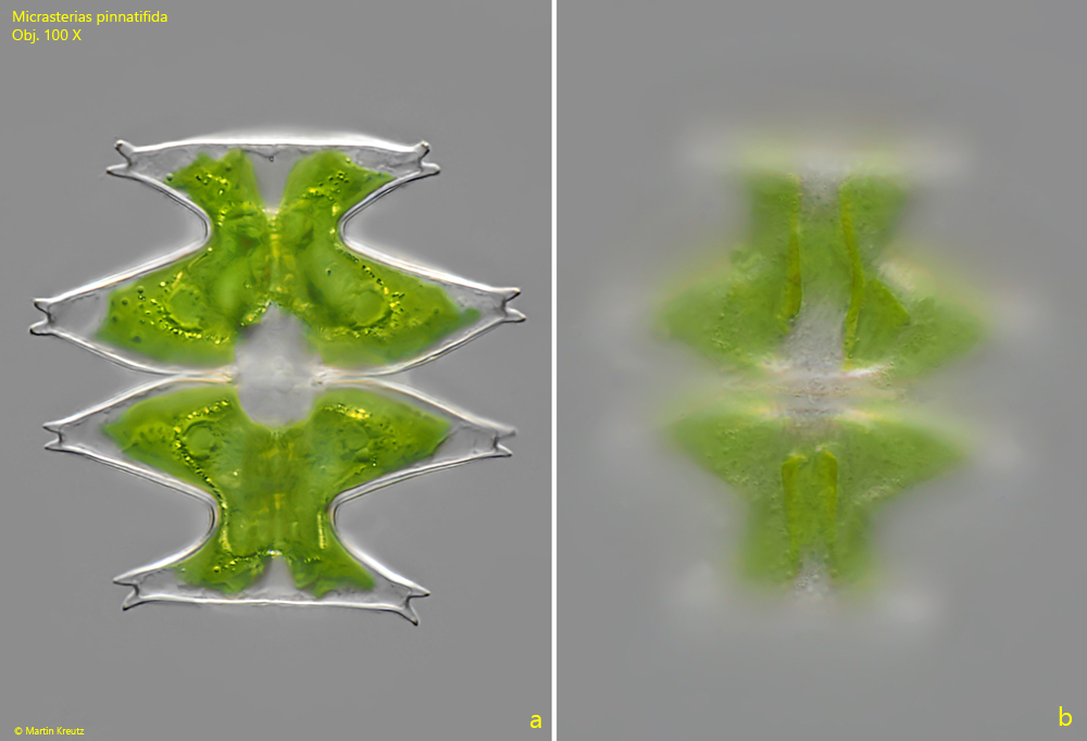 Micrasterias-pinnatifida