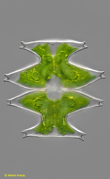 Micrasterias-pinnatifida