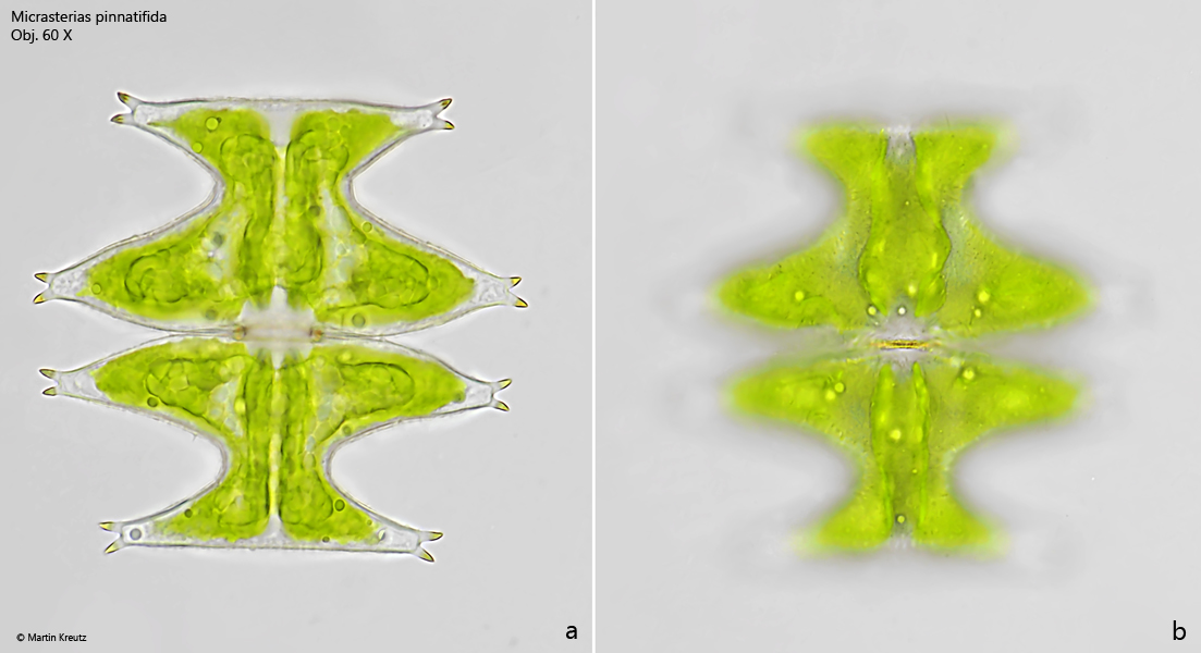 Micrasterias-pinnatifida