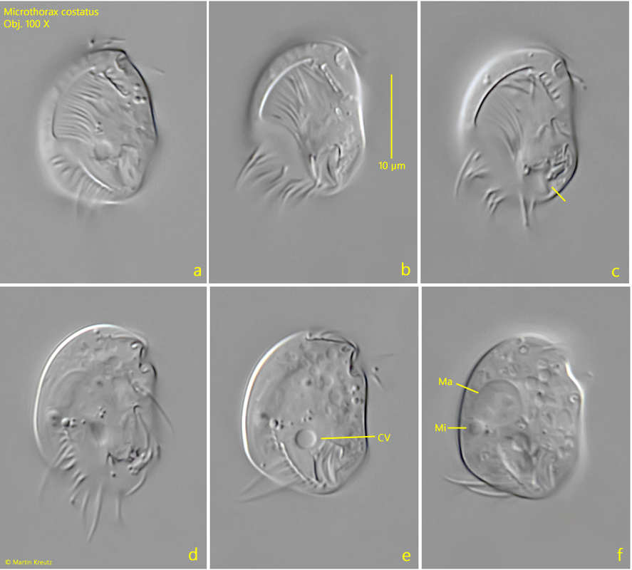Microthorax-costatus