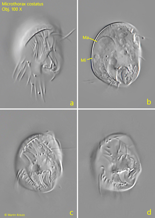 Microthorax-costatus