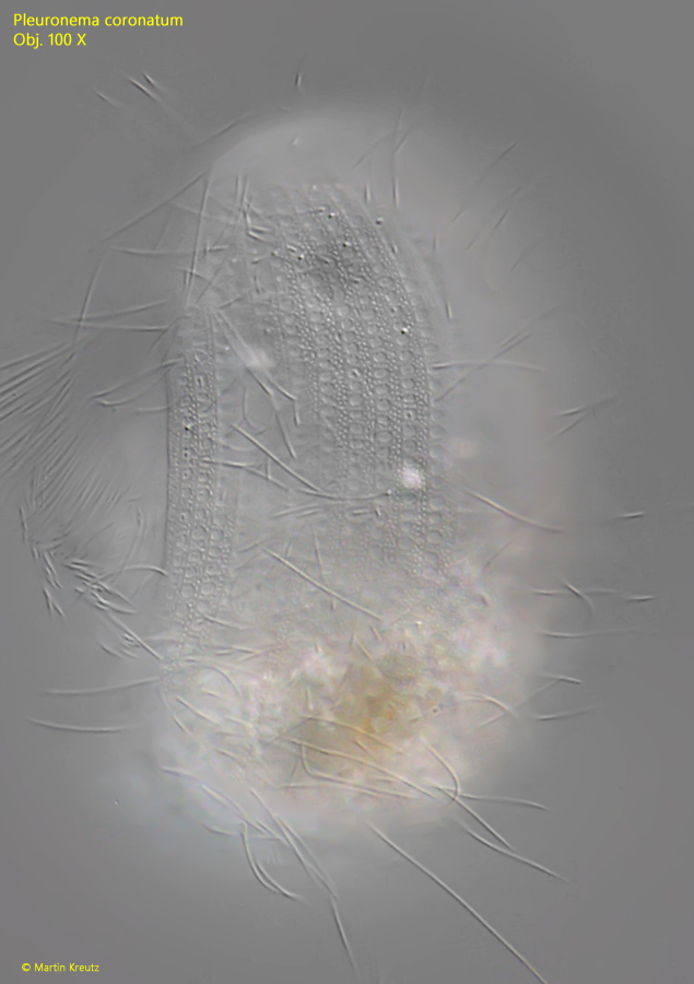 Pleuronema-coronatum