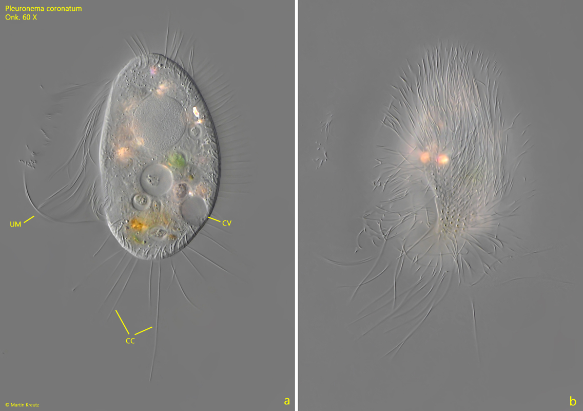 Pleuronema-coronatum
