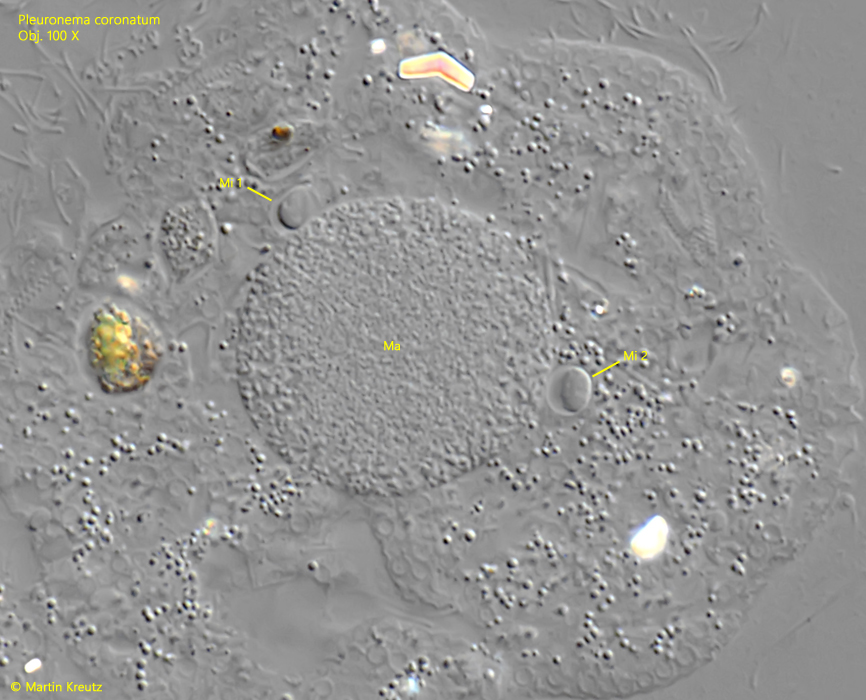 Pleuronema-coronatum