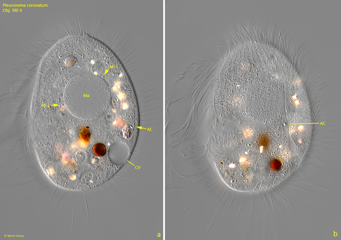 Pleuronema-coronatum