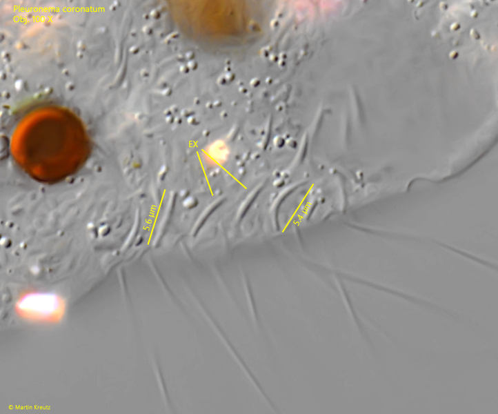 Pleuronema-coronatum