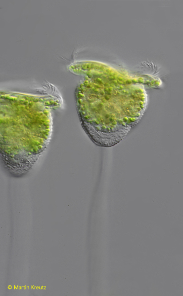 Pseudovorticella-fasciculata