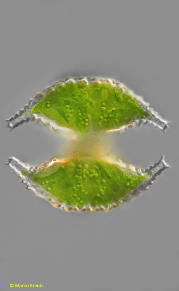 Staurastrum-traunsteineri