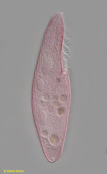 Blepharisma-americanum