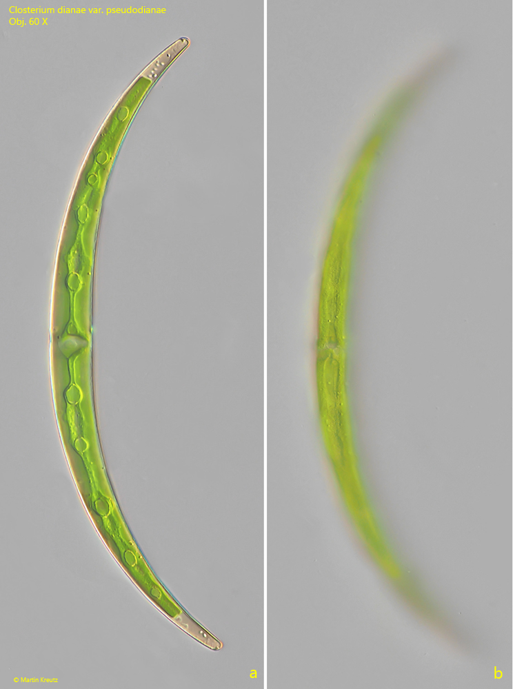 Closterium-dianae-var-pseudodianae