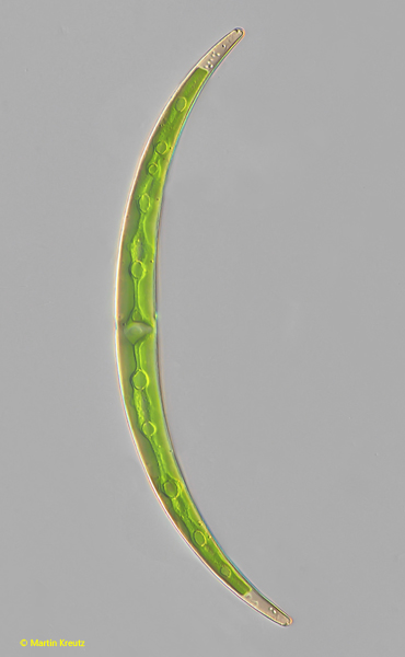 Closterium-dianae-var-pseudodianae