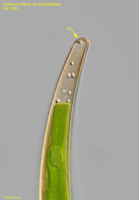 Closterium-dianae-var-pseudodianae