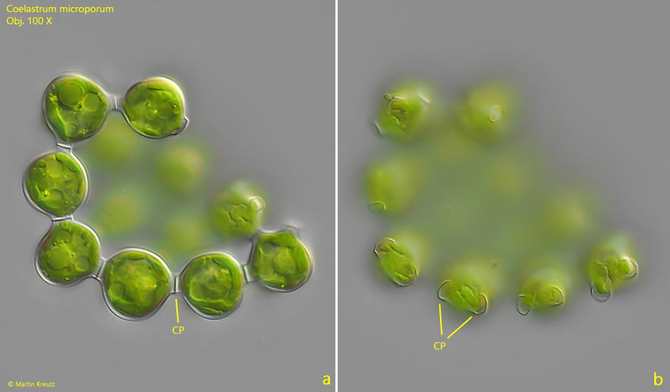 Coelastrum-microporum