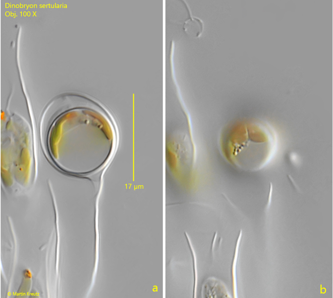 Dinobryon-sertularia