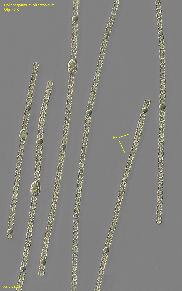 Dolichospermum-planctonicum