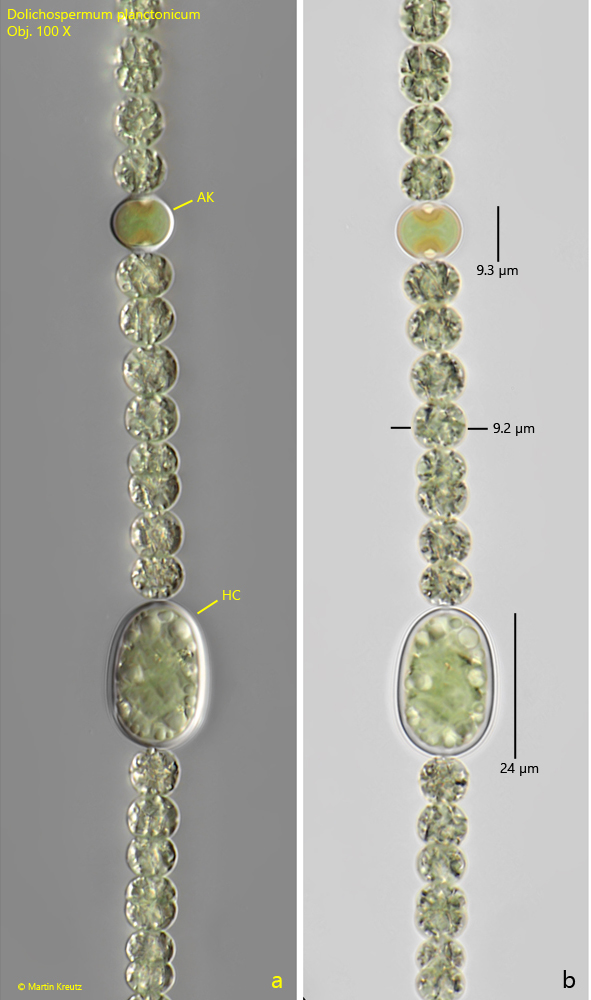 Dolichospermum-planctonicum