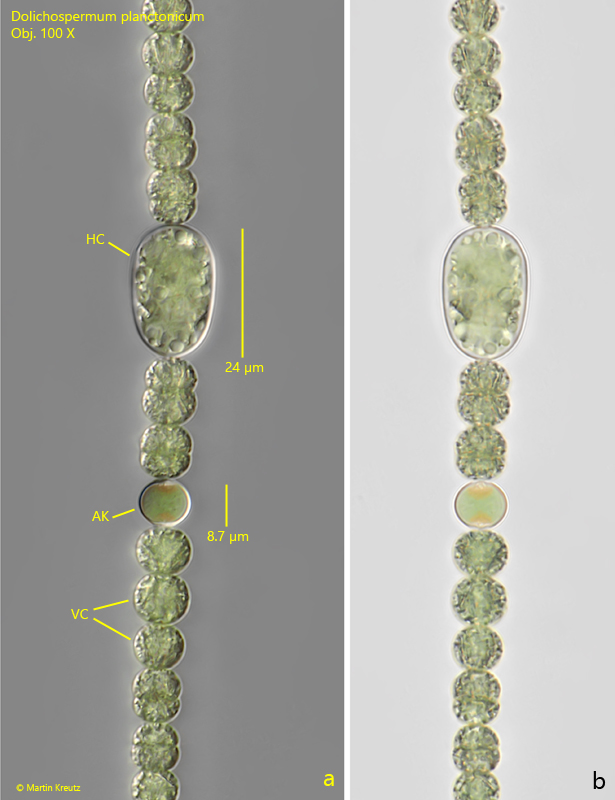 Dolichospermum-planctonicum