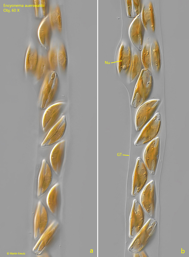 Encyonema-auerswaldii