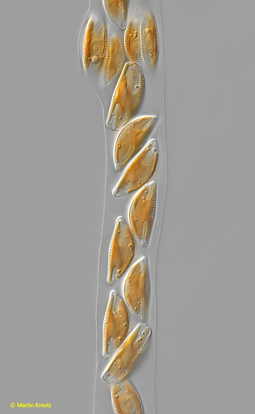 Encyonema-auerswaldii