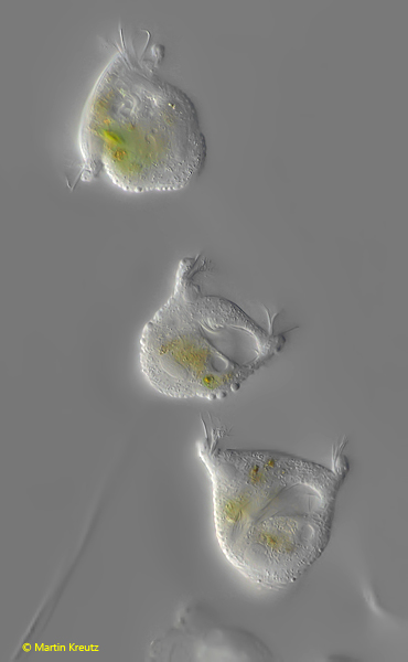 Pseudovorticella-monilata