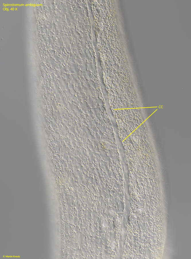 Spirostomum-ambiguum