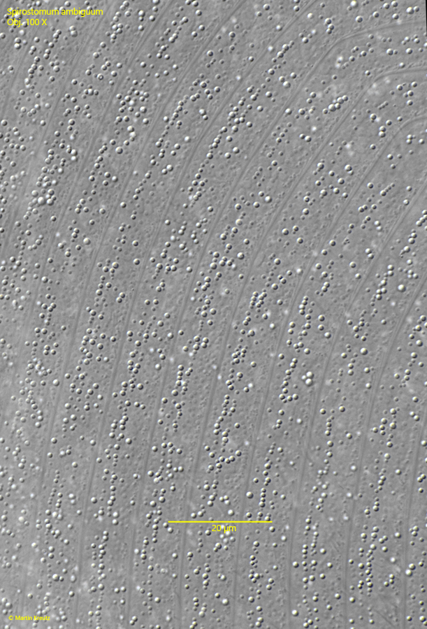 Spirostomum-ambiguum