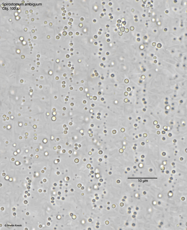 Spirostomum-ambiguum